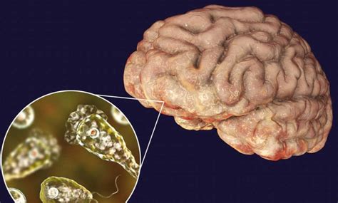  Naegleria fowleri – Parasitic Microbe Known for its Brain-Eating Habits