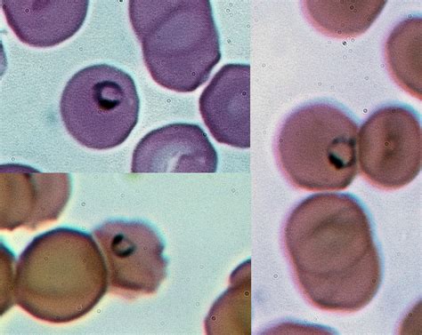  Plasmodium - Parasiitille mausteita ja verta täydeksi!